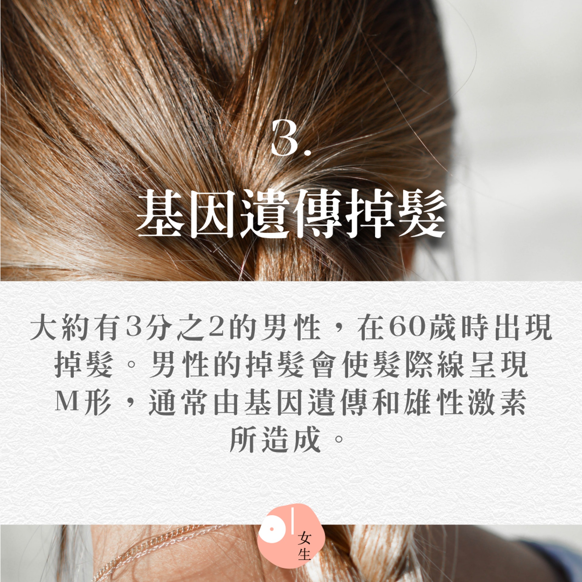 【11個會掉髮的原因】（Unsplash@Tamara Bellis／香港01製圖／414409）