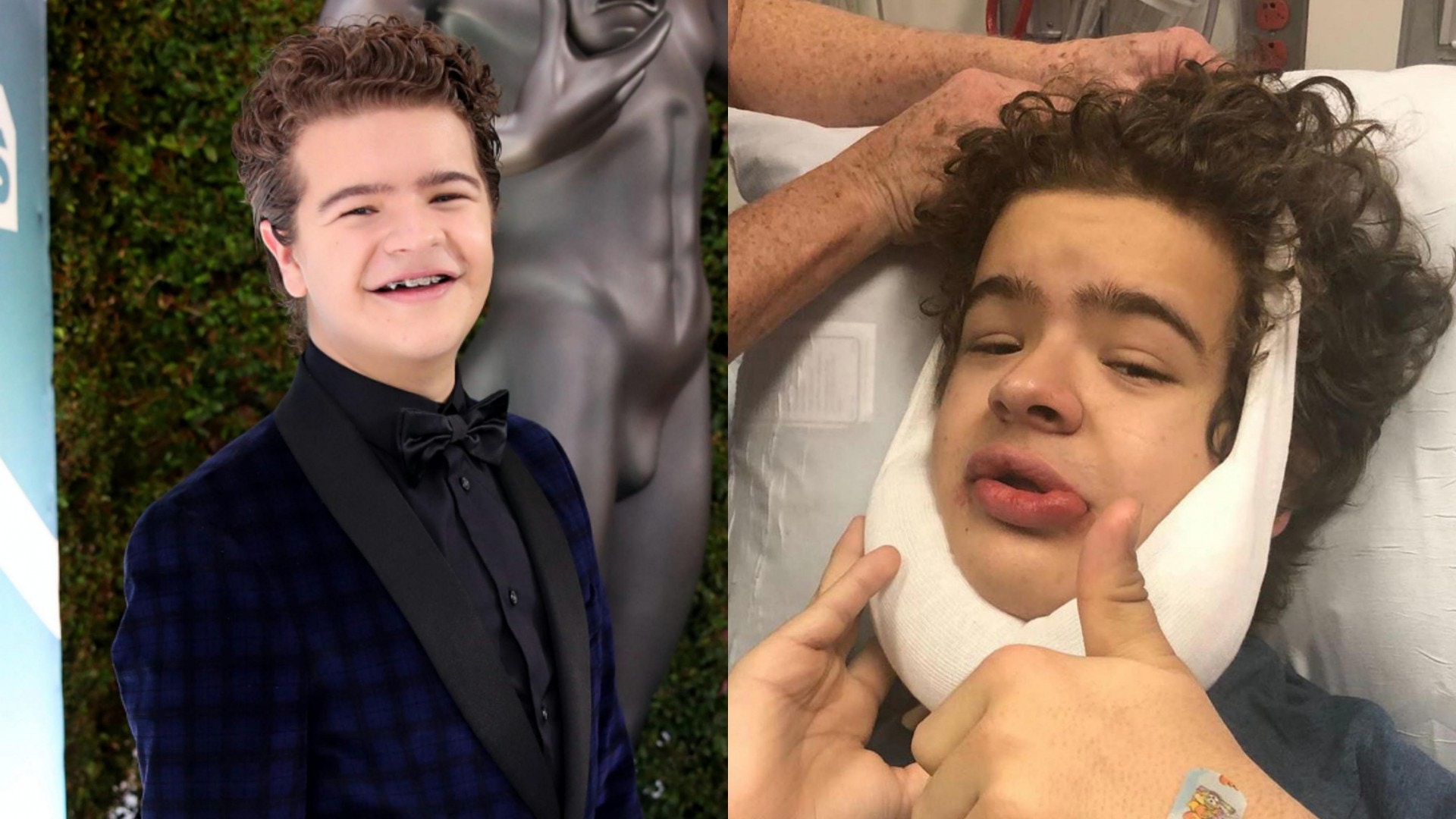 怪奇物語 Dustin患怪病需做4次手術一次過拔除14顆多餘牙齒 香港01 即時娛樂