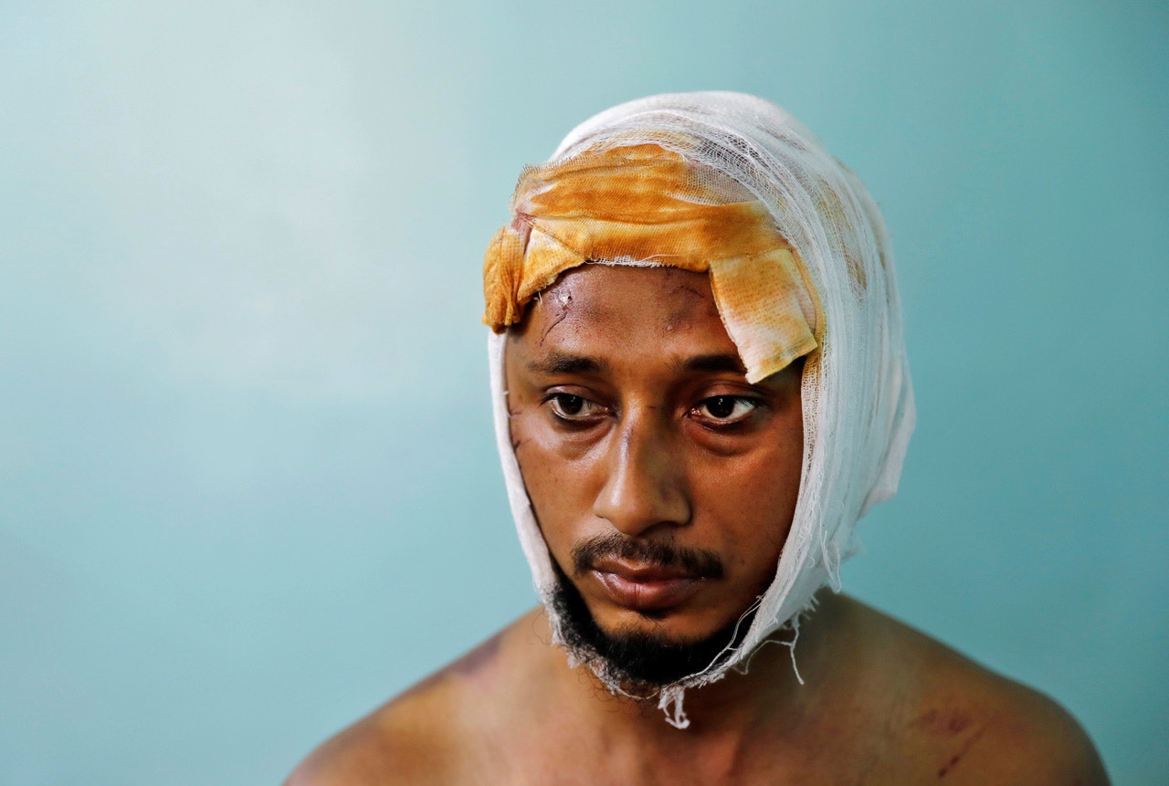 Mohammad Zubair（37岁）遭围殴受伤。（Danish Siddiqui／路透社）