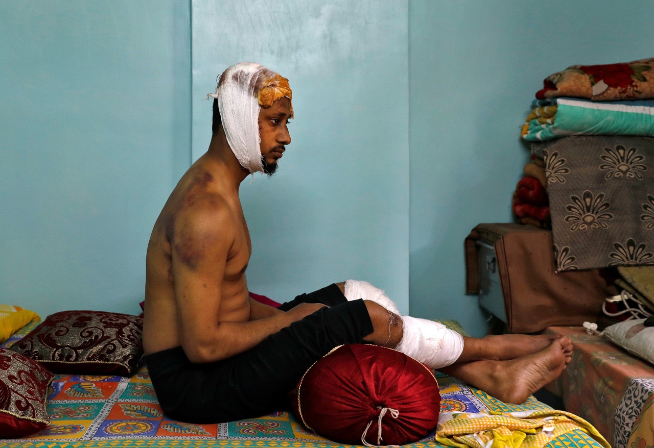 Mohammad Zubair於2月24日遭圍毆,26日接受路透社訪問時頭部及腿部都包上繃帶。(Danish Siddiqui/路透社)