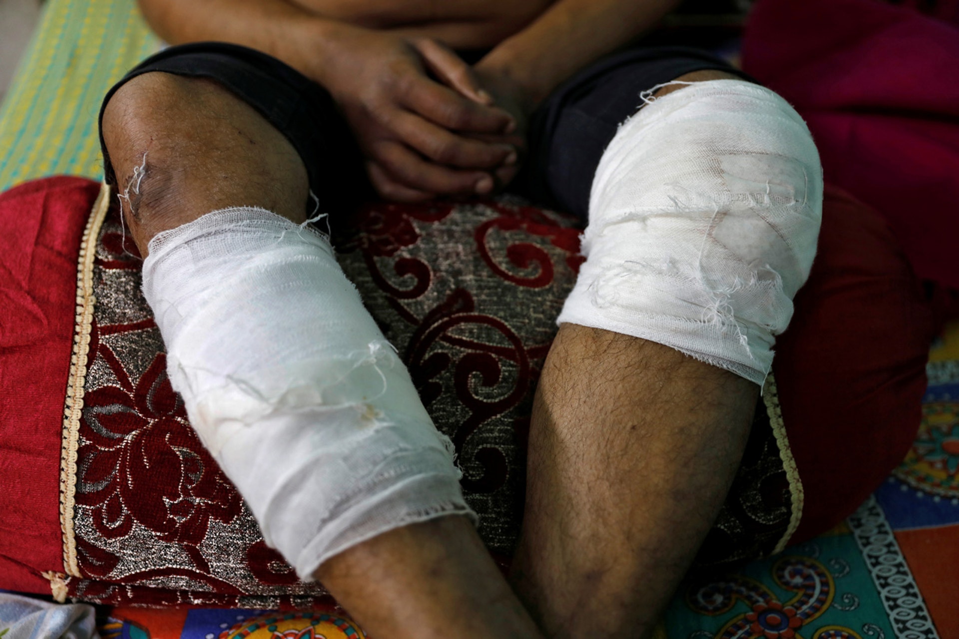 Mohammad Zubair腿上包着繃帶。(Danish Siddiqui/路透社)