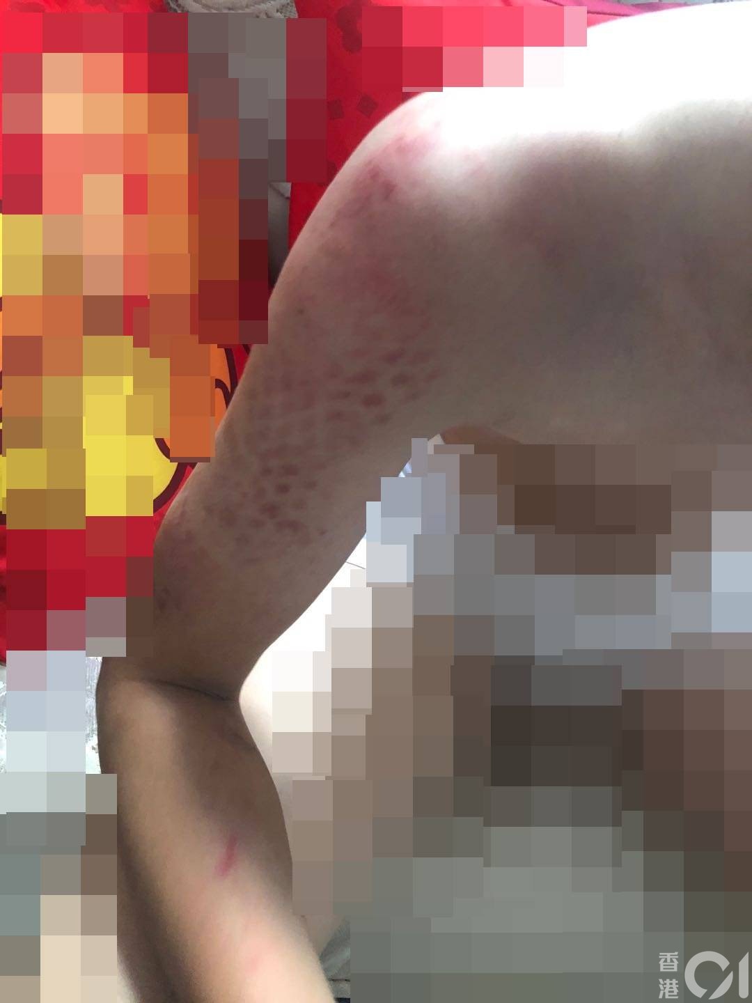 01獨家 牛丸事件2 0 安定邨再爆童黨欺凌13歲男童遭毒打 香港01 突發
