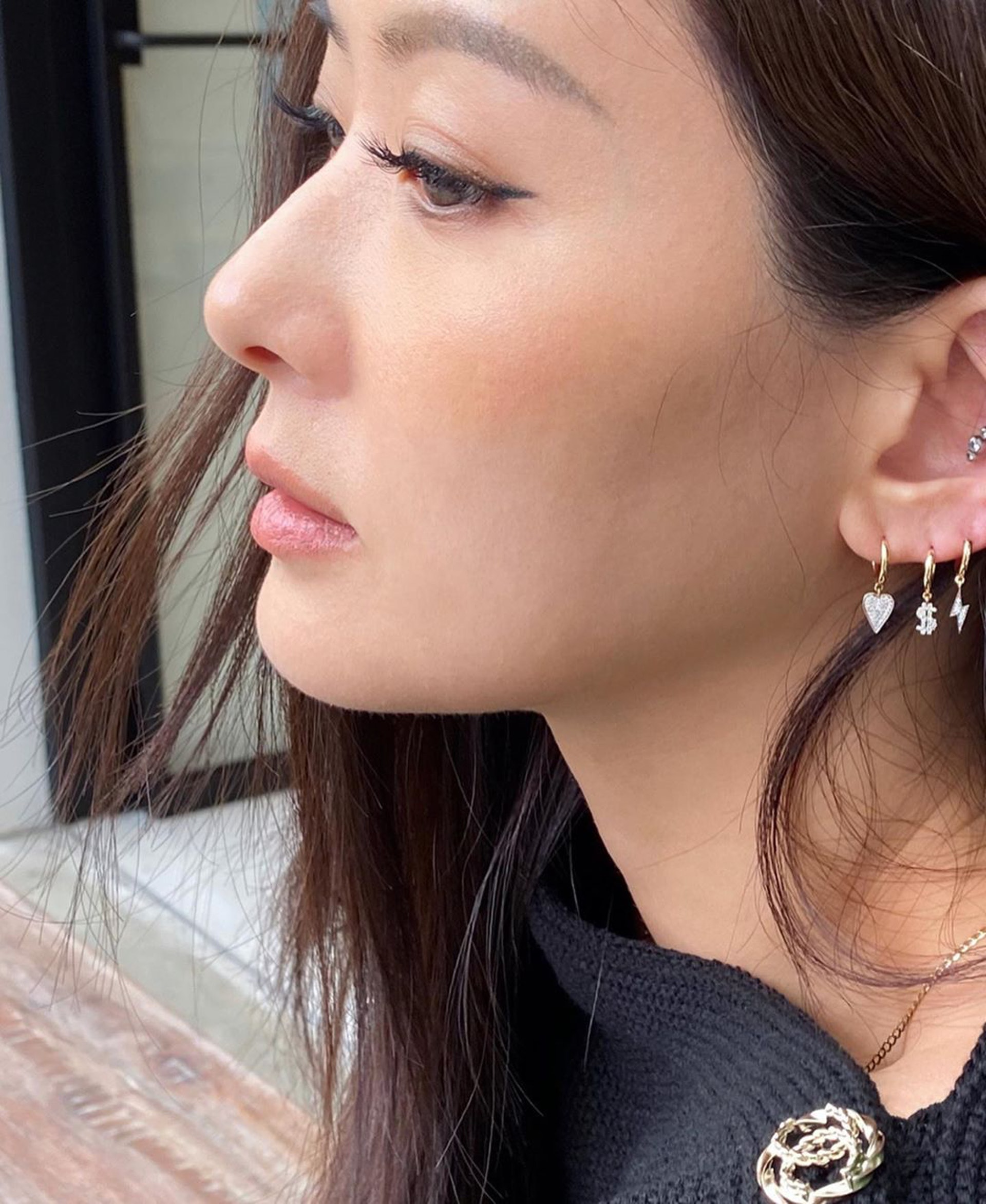 孫芸芸毫不忌諱分享她的肌膚狀況。(aimeeyunyunsun@instagram) 孫芸芸毫不忌諱分享她的肌膚狀況。(aimeeyunyunsun@instagram)