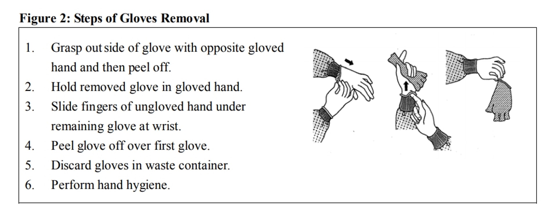 脫下手套步驟。(衞生署文件)