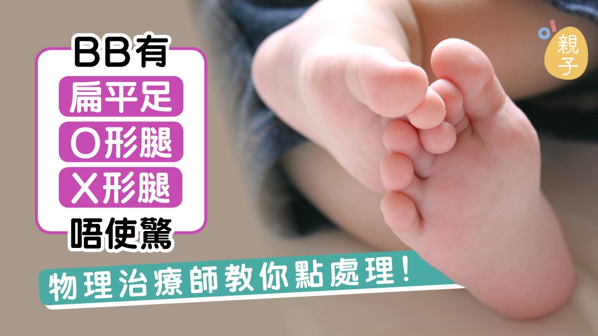 扁平足勿急着買矯形鞋墊9成長大後恢復正常這樣走路可改善 香港01 親子 扁平足勿急着買矯形鞋墊9成長大後恢復正常這樣走路可改善 香港01 親子