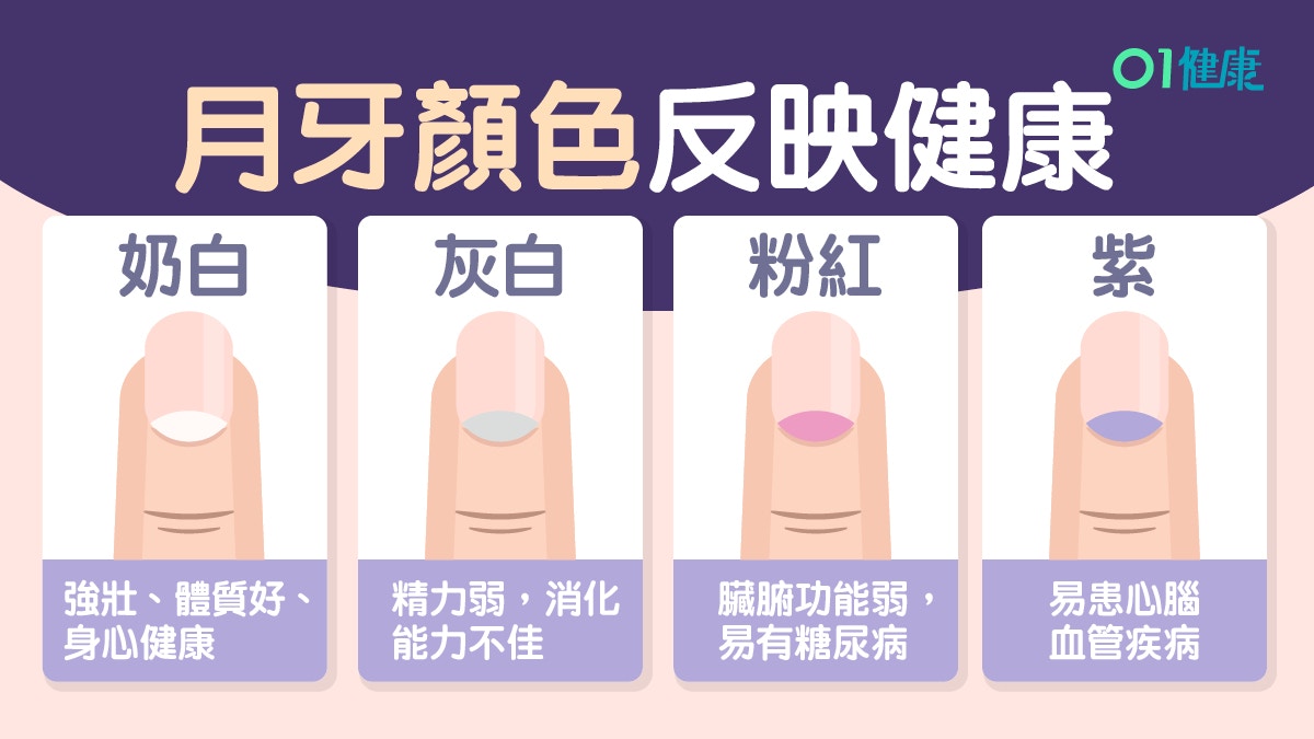 指甲健康 月牙紫色防心臟病灰色脾胃差指甲有橫紋白斑是 香港01 健康 指甲健康 月牙紫色防心臟病灰色脾胃差指甲有橫紋白斑是 香港01 健康