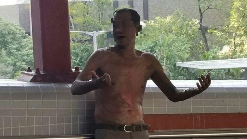 馬鞍山火人案 夫婦被指現場喧嘩被控 官裁定擾亂秩序罪不成立 馬鞍山火人案 夫婦被指現場喧嘩被控 官裁定擾亂秩序罪不成立