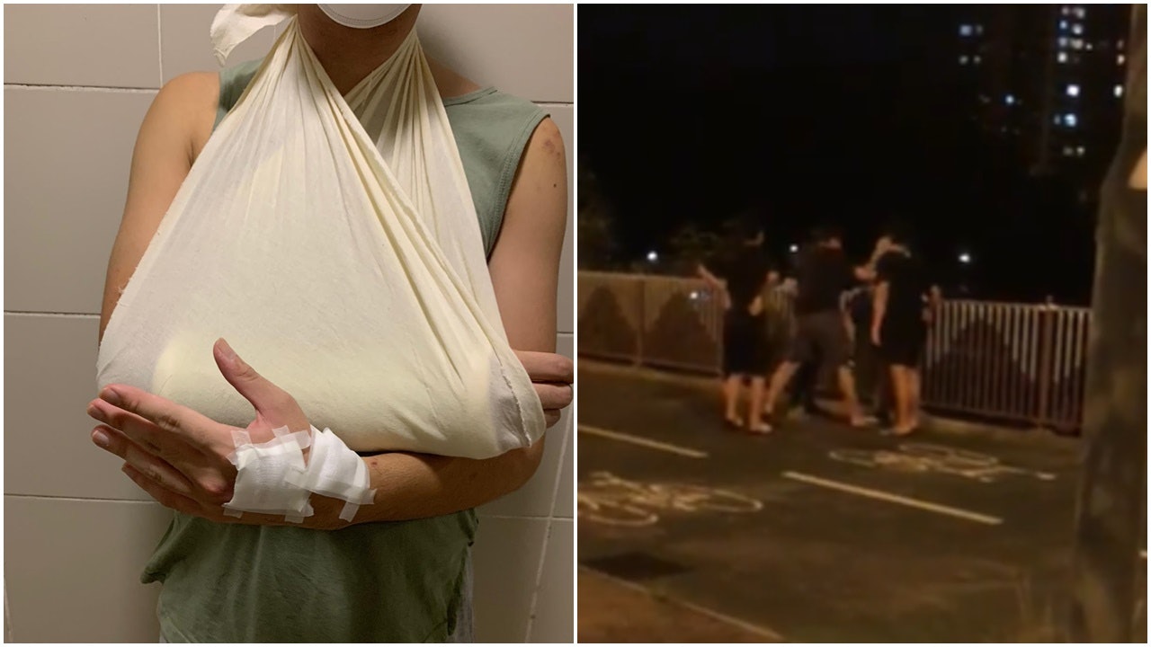 將軍澳單車男遭4人圍毆至面骨裂 警反黑組拘24歲仔涉傷人 將軍澳單車男遭4人圍毆至面骨裂 警反黑組拘24歲仔涉傷人