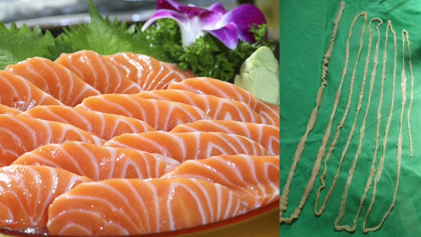 手拉寄生蟲 美國男日日食三文魚刺身上廁所拉出1 6米日本絛蟲