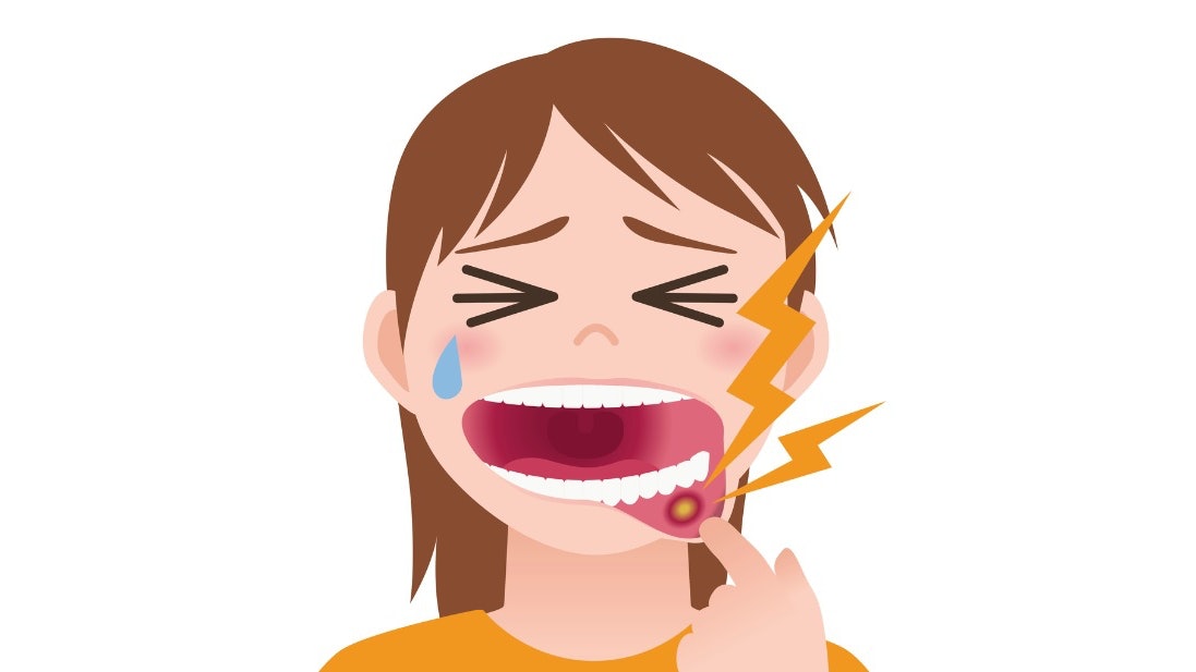 【生痱滋食乜好?】骨膠原助傷口癒合 奇異果西蘭花都得? 【生痱滋食乜好?】骨膠原助傷口癒合 奇異果西蘭花都得?