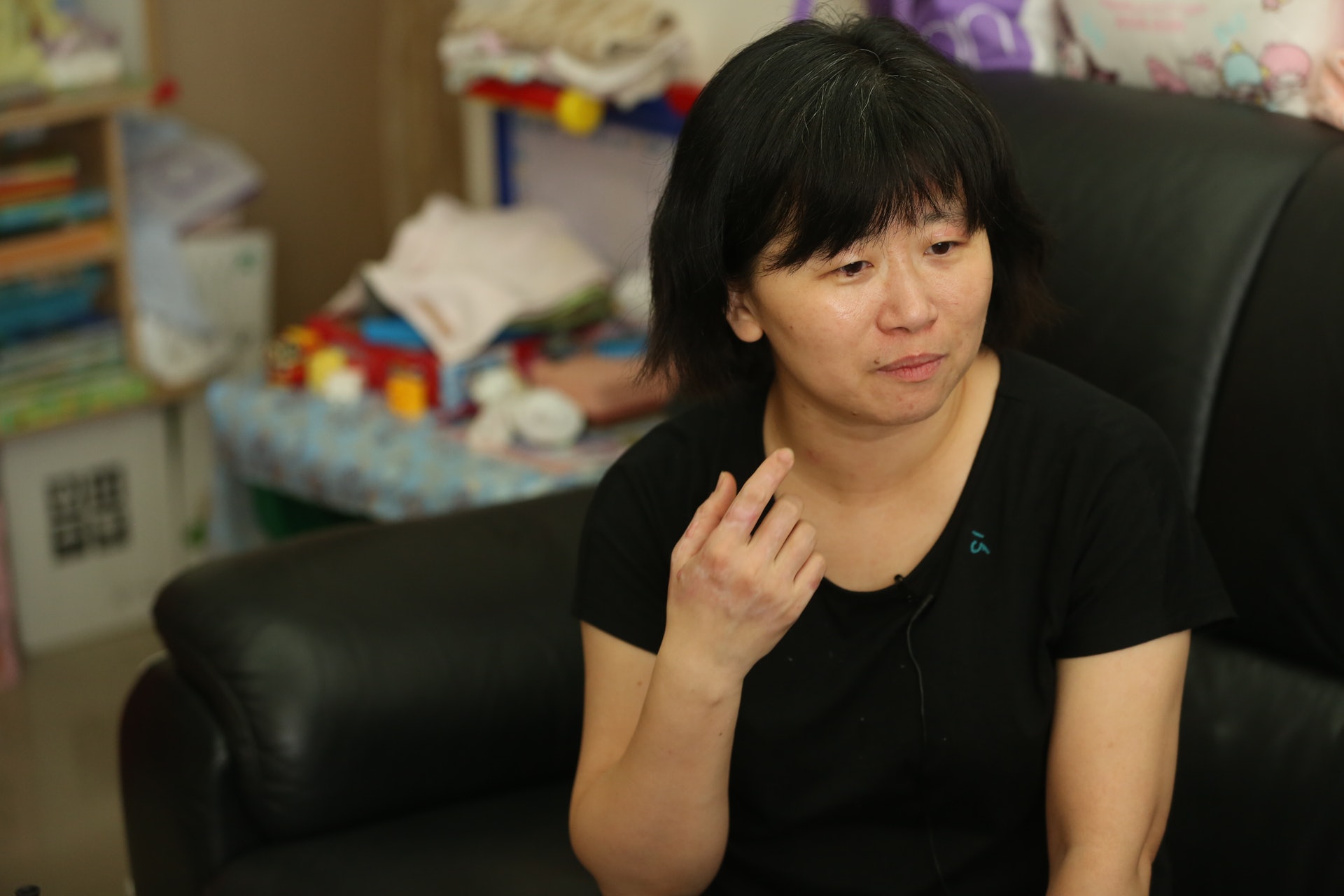 港鐵縱火案:38歲台灣女遊客張欣茹,額頭和眼皮仍泛紅,右手凸出一顆又一顆的疤痕。(蔡正邦攝) 港鐵縱火案:38歲台灣女遊客張欣茹,額頭和眼皮仍泛紅,右手凸出一顆又一顆的疤痕。(蔡正邦攝)