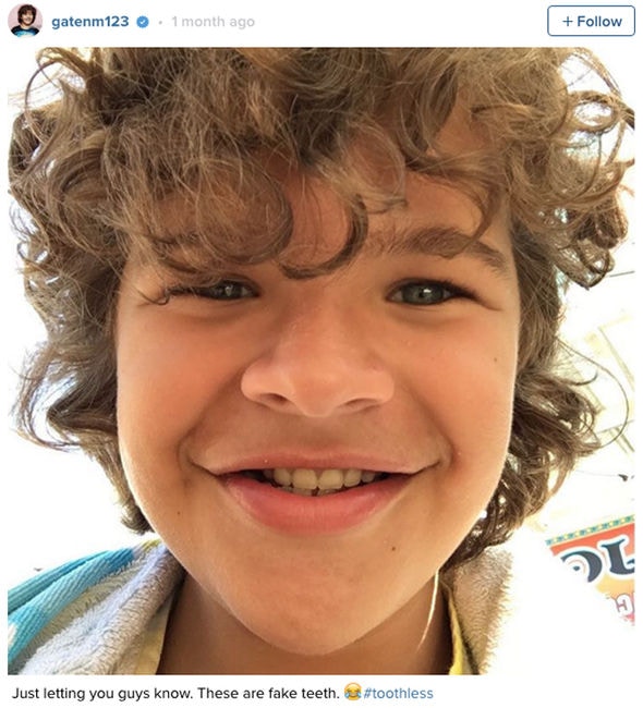 怪奇物語 15歲dustin天生患骨骼怪病夢想成名後帶給大家歡樂 香港01 電影