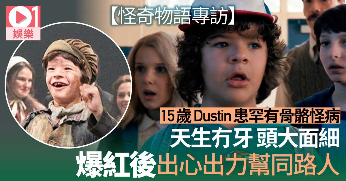 怪奇物語 15歲dustin天生患骨骼怪病夢想成名後帶給大家歡樂 香港01 電影