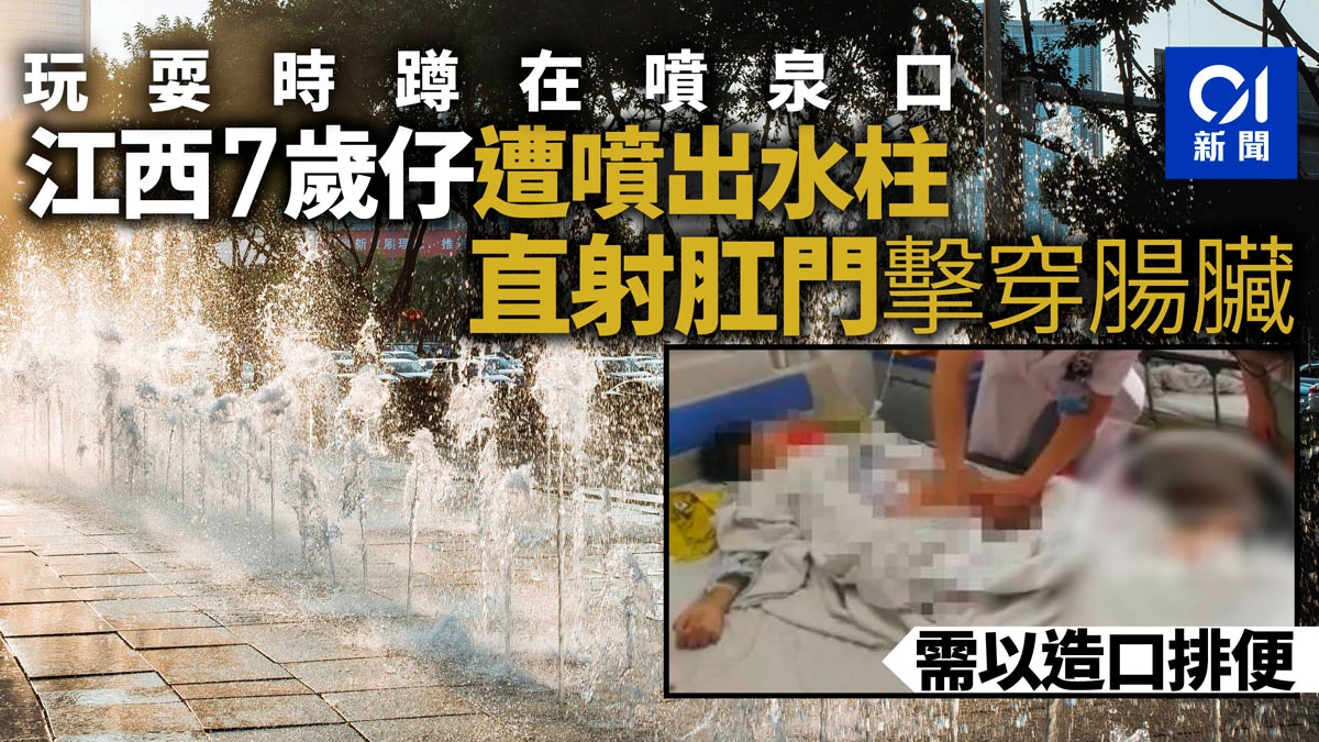 江西男童在音樂噴泉玩耍出意外　水柱突然射入臀部擊穿腸臟