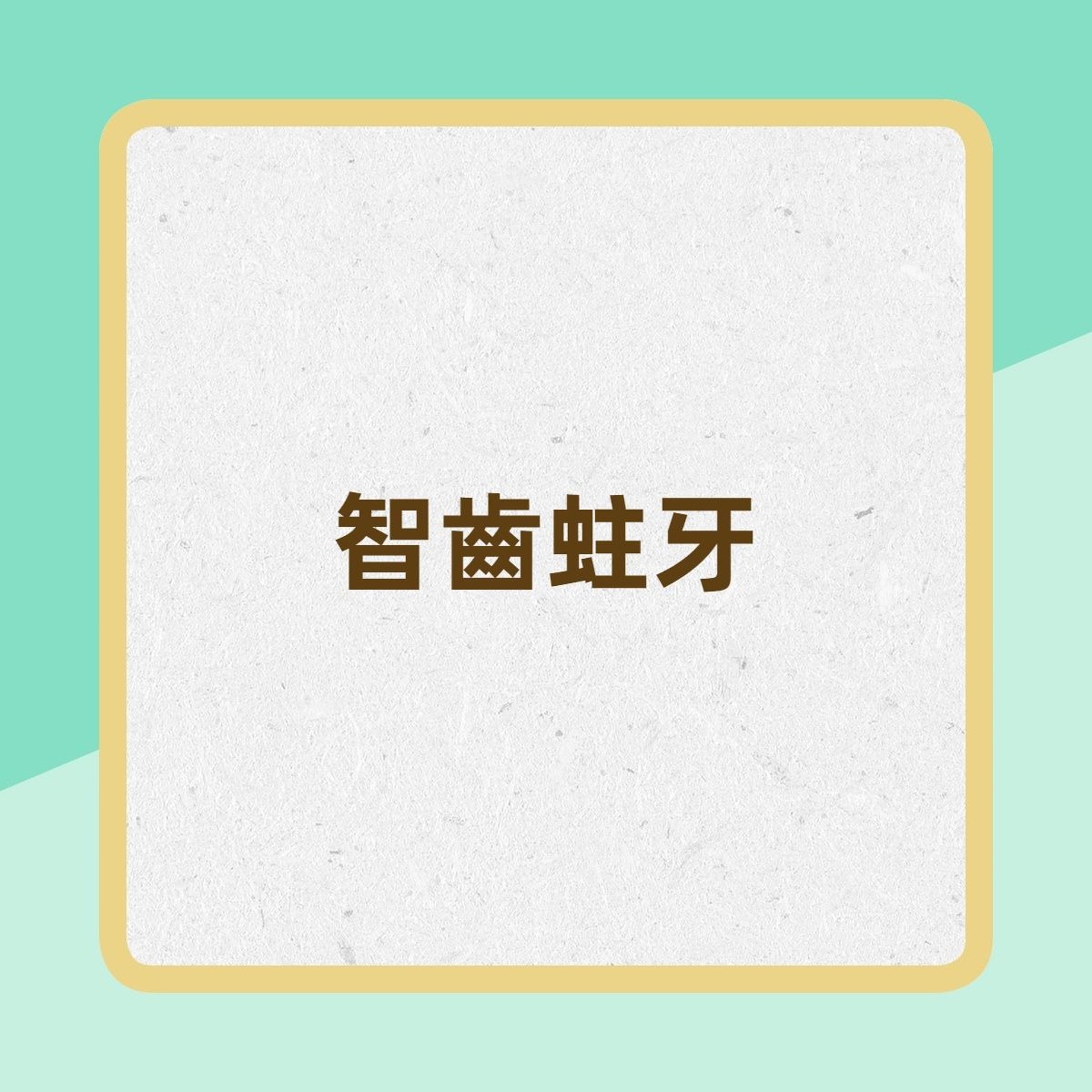 剝智慧齒遭鑽爛喉嚨未係最慘 事後食飯米粒卡洞傷口照片嚇窒人 香港01 熱爆話題 剝智慧齒遭鑽爛喉嚨未係最慘 事後食飯米粒卡洞傷口照片嚇窒人 香港01 熱爆話題