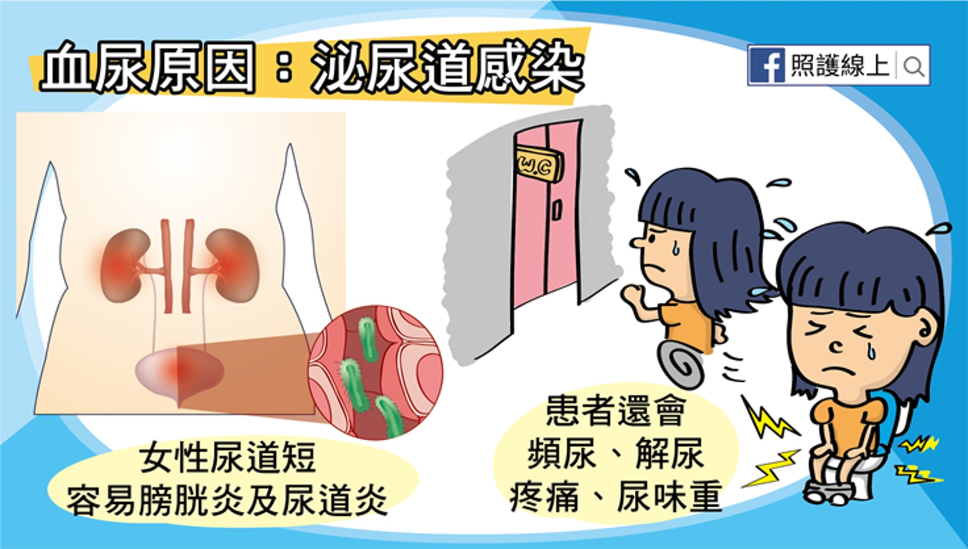 血尿原因：泌尿道感染（照護線上授權使用）