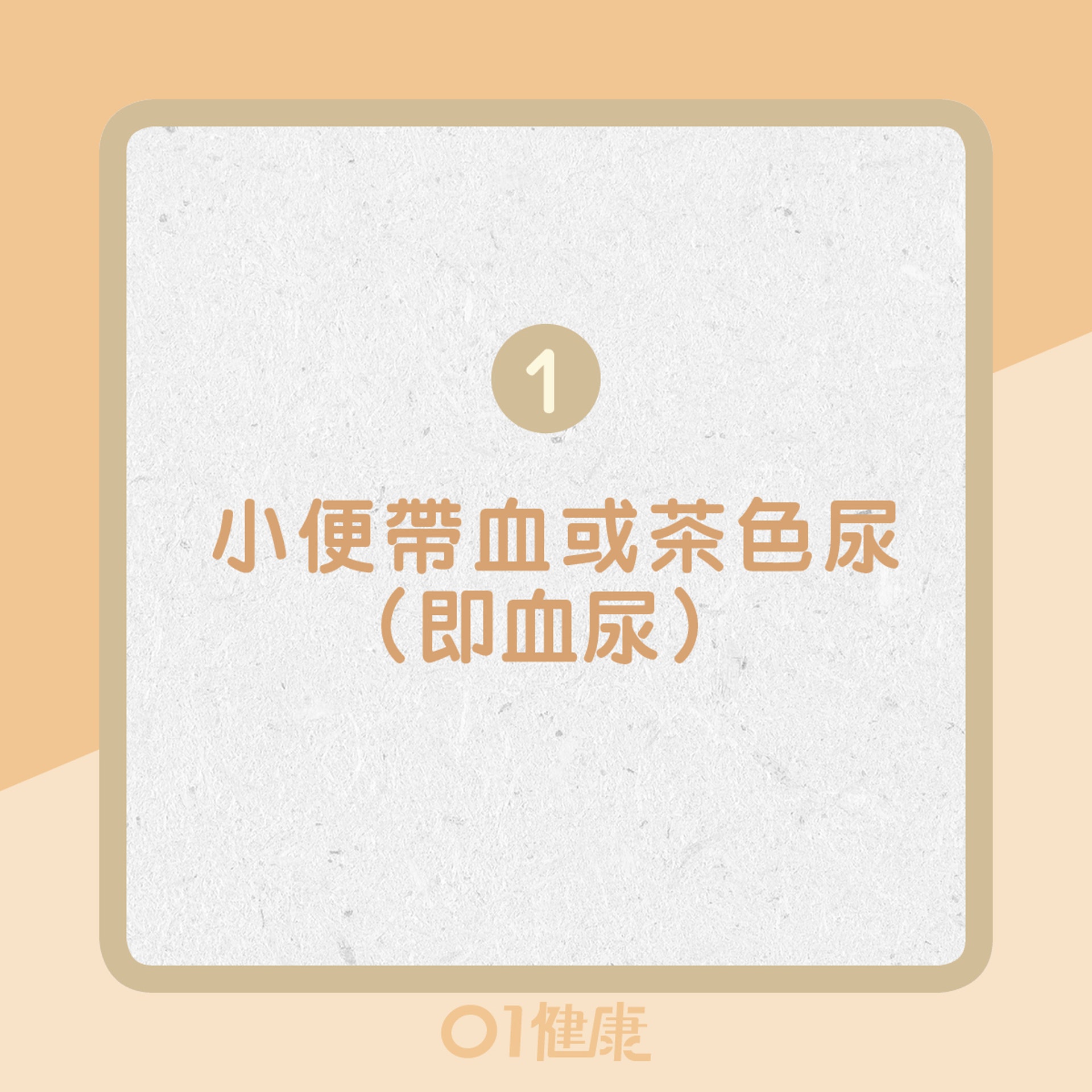 1. 小便帶血或茶色尿(即血尿)(01製圖) 1. 小便帶血或茶色尿(即血尿)(01製圖)