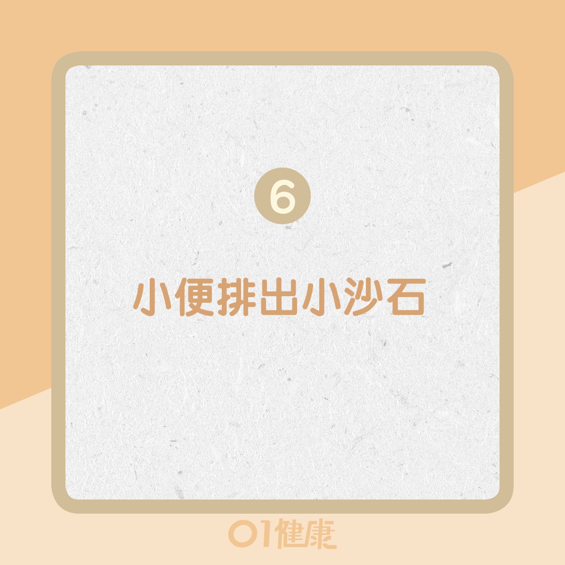 6. 小便排出小沙石(01製圖) 6. 小便排出小沙石(01製圖)