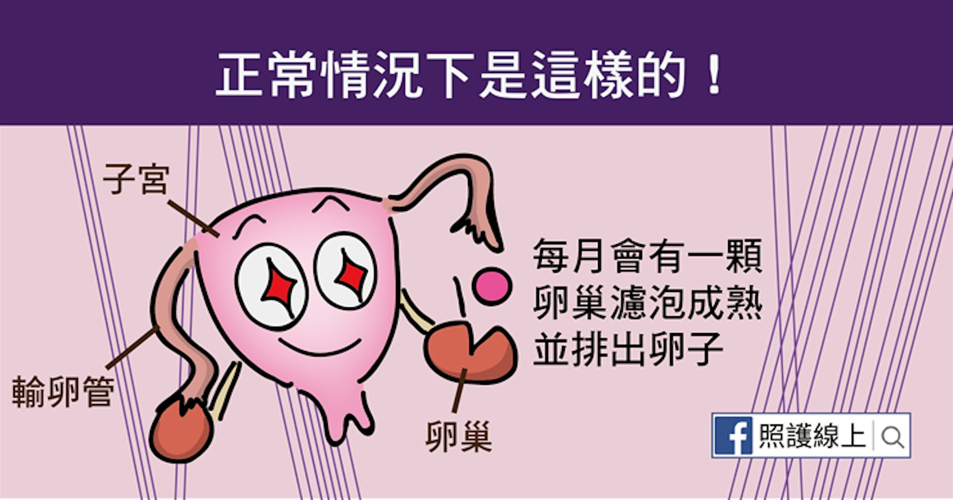 正常的狀況下,每個月其中會有幾顆濾泡發育生長,最後會有一顆濾泡成熟並排出卵子。(照護線上授權使用) 正常的狀況下,每個月其中會有幾顆濾泡發育生長,最後會有一顆濾泡成熟並排出卵子。(照護線上授權使用)