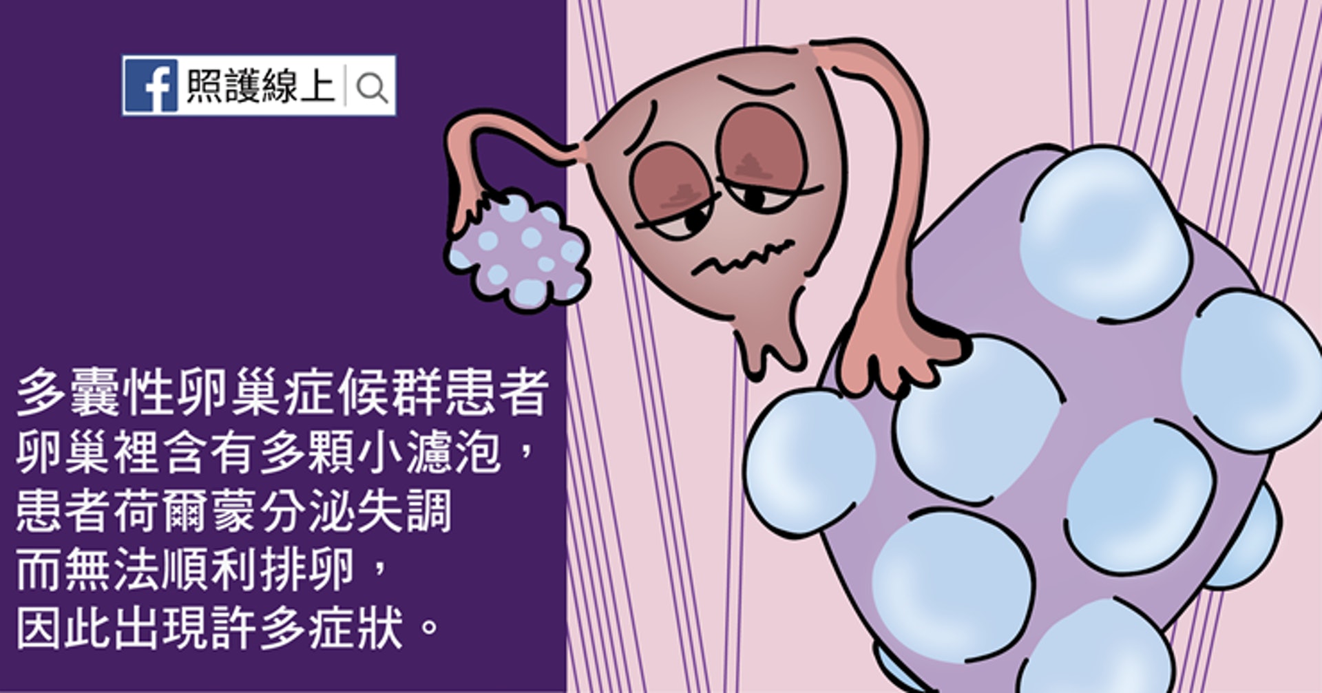 當患者內分泌失調,就會干擾正常排卵。(照護線上授權使用) 當患者內分泌失調,就會干擾正常排卵。(照護線上授權使用)