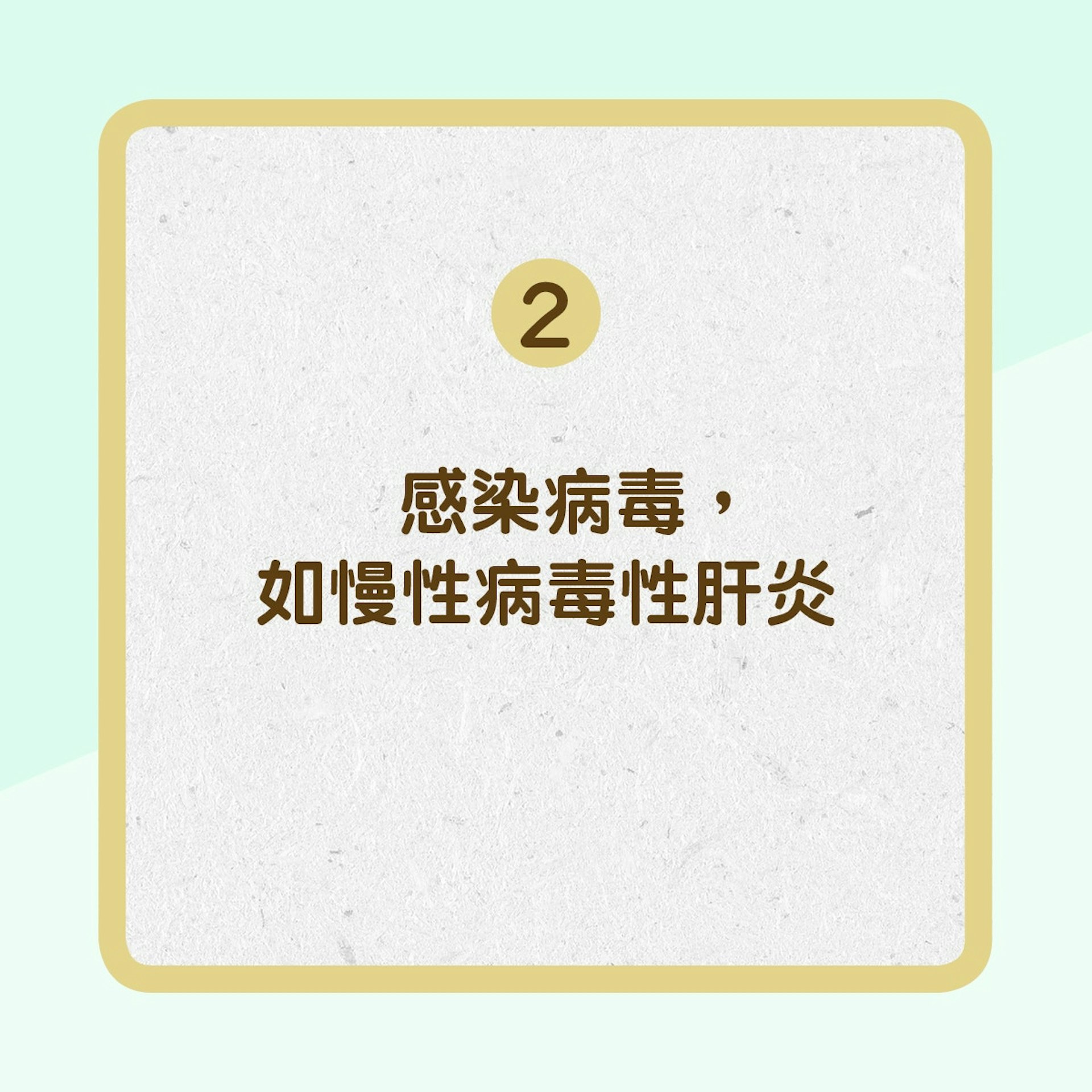 【肝硬化的成因】2. 感染病毒(01製圖) 【肝硬化的成因】2. 感染病毒(01製圖)