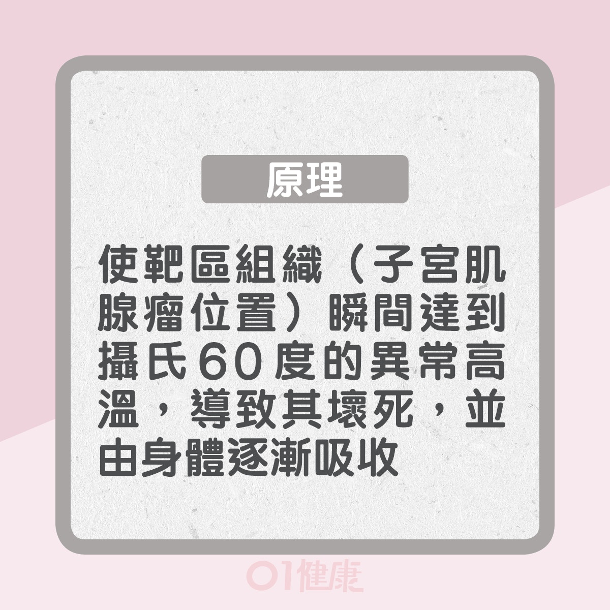 原理：使靶區組織（子宮肌腺瘤位置）瞬間達到攝氏60度的異常高溫，導致其壞死，並由身體逐漸吸收（01製圖）