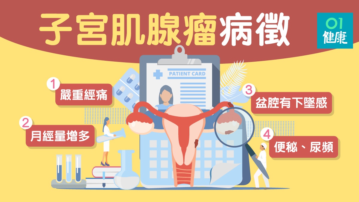 子宮肌腺瘤 子宮增大或致月經量增 便秘嚴重可令懷孕率大減 香港01 健康