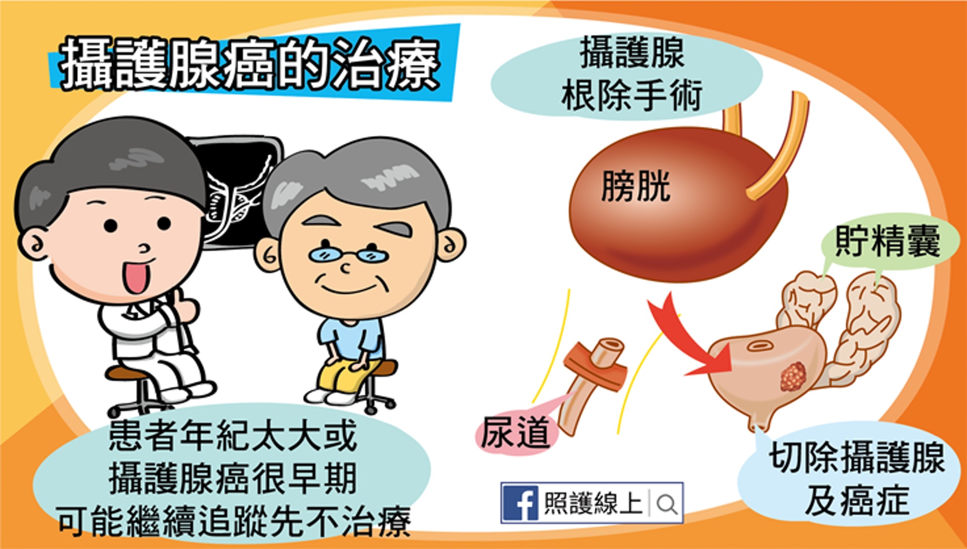 前列腺癌的治療(照護線上授權使用) 前列腺癌的治療(照護線上授權使用)