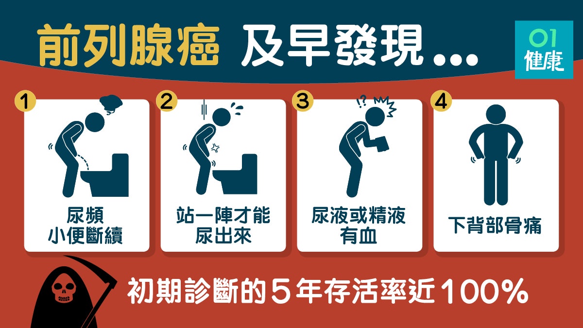 【前列腺癌】初期徵狀與前列腺肥近似 少吃高脂食品及紅肉減風險 【前列腺癌】初期徵狀與前列腺肥近似 少吃高脂食品及紅肉減風險