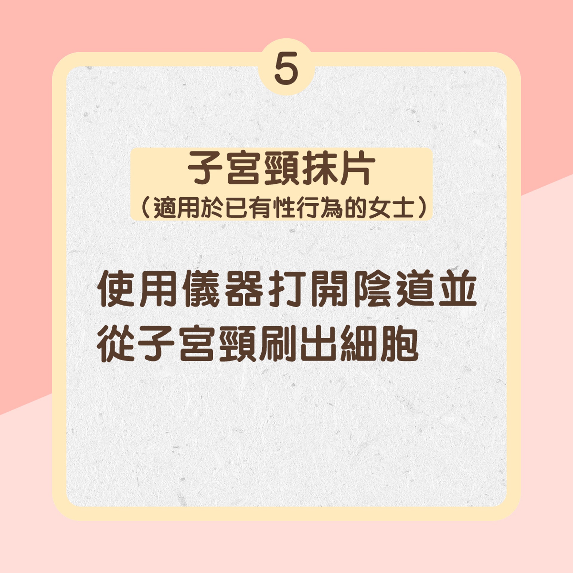 5. 子宮頸抹片(適用於已有性行為的女士):使用儀器打開陰道並從子宮頸刷出細胞(01製圖) 5. 子宮頸抹片(適用於已有性行為的女士):使用儀器打開陰道並從子宮頸刷出細胞(01製圖)