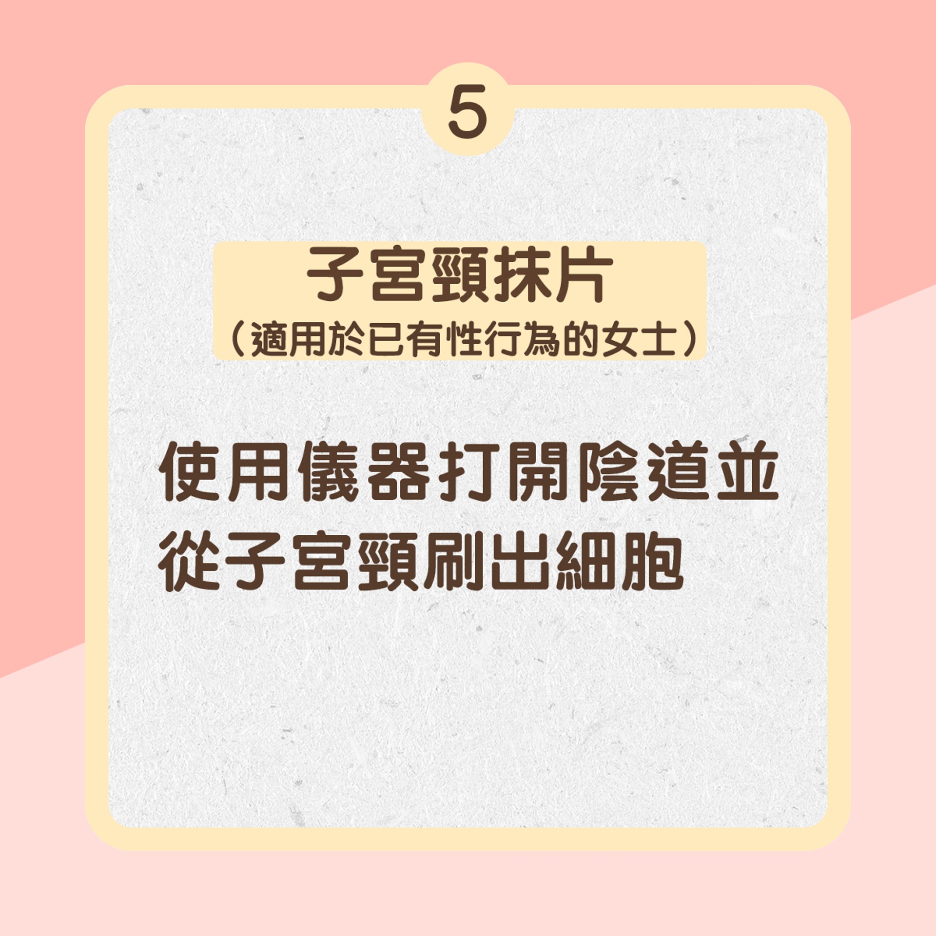 5. 子宮頸抹片（適用於已有性行為的女士）：使用儀器打開陰道並從子宮頸刷出細胞（01製圖）