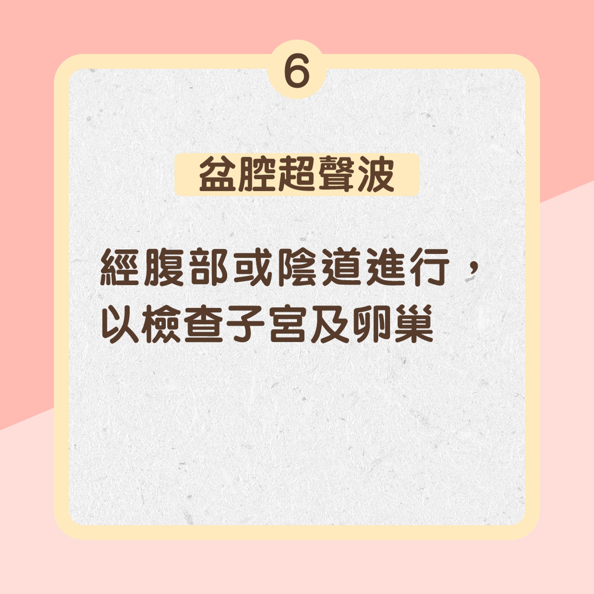 6. 盆腔超聲波：經腹部或陰道進行，以檢查子宮及卵巢（01製圖）