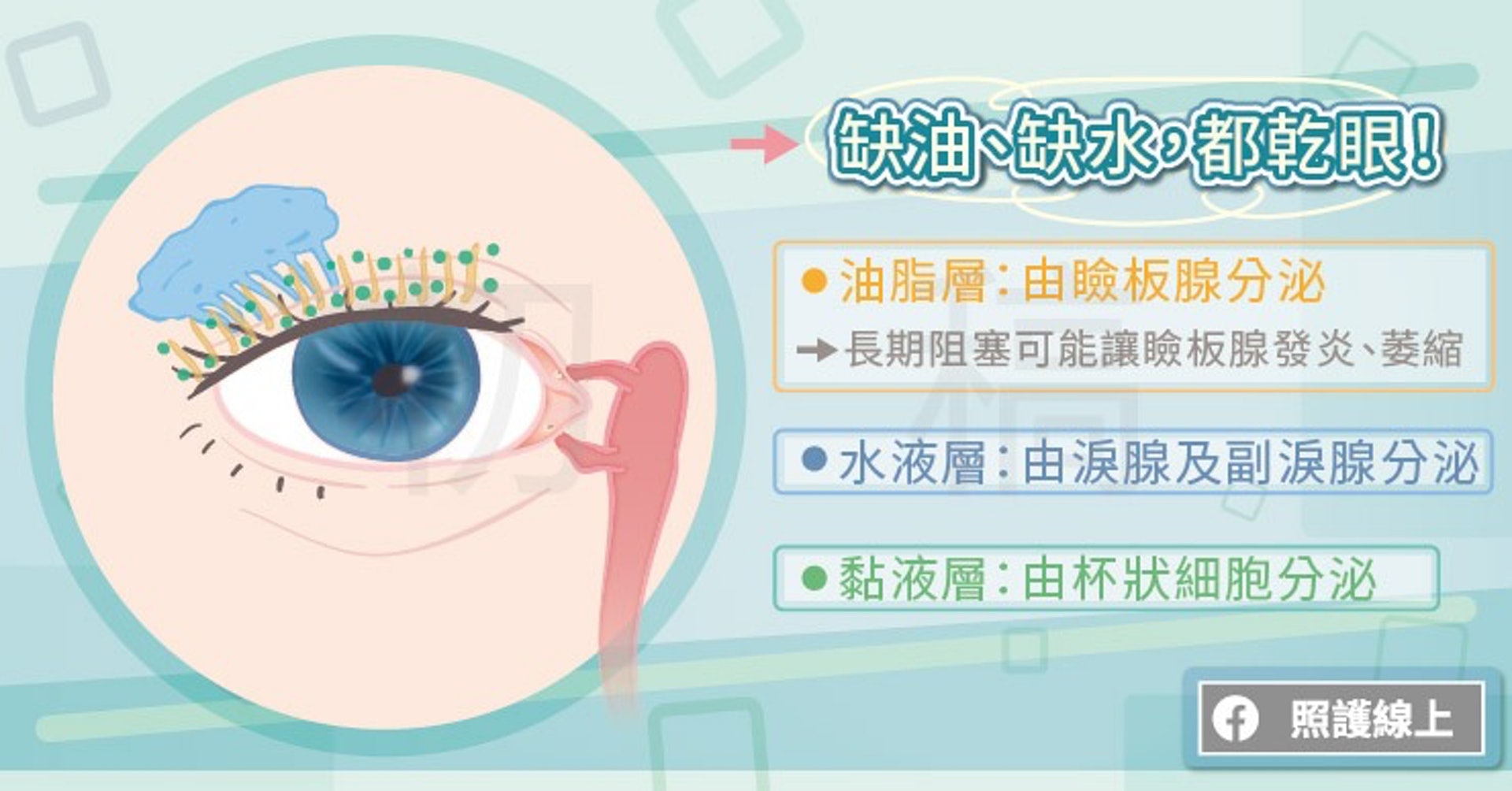 我們的淚液並非單單只有水,其中包含了油脂、水、和黏液,分別由不同的腺體分泌。(照護線上授權使用) 我們的淚液並非單單只有水,其中包含了油脂、水、和黏液,分別由不同的腺體分泌。(照護線上授權使用)
