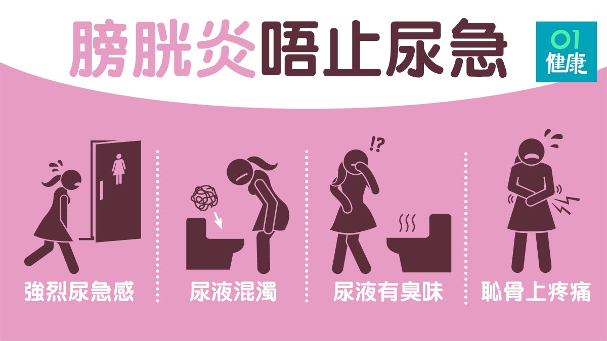 膀胱炎 細菌經尿道造成膀胱發炎排尿疼嚴重可致發燒及背痛 香港01 健康