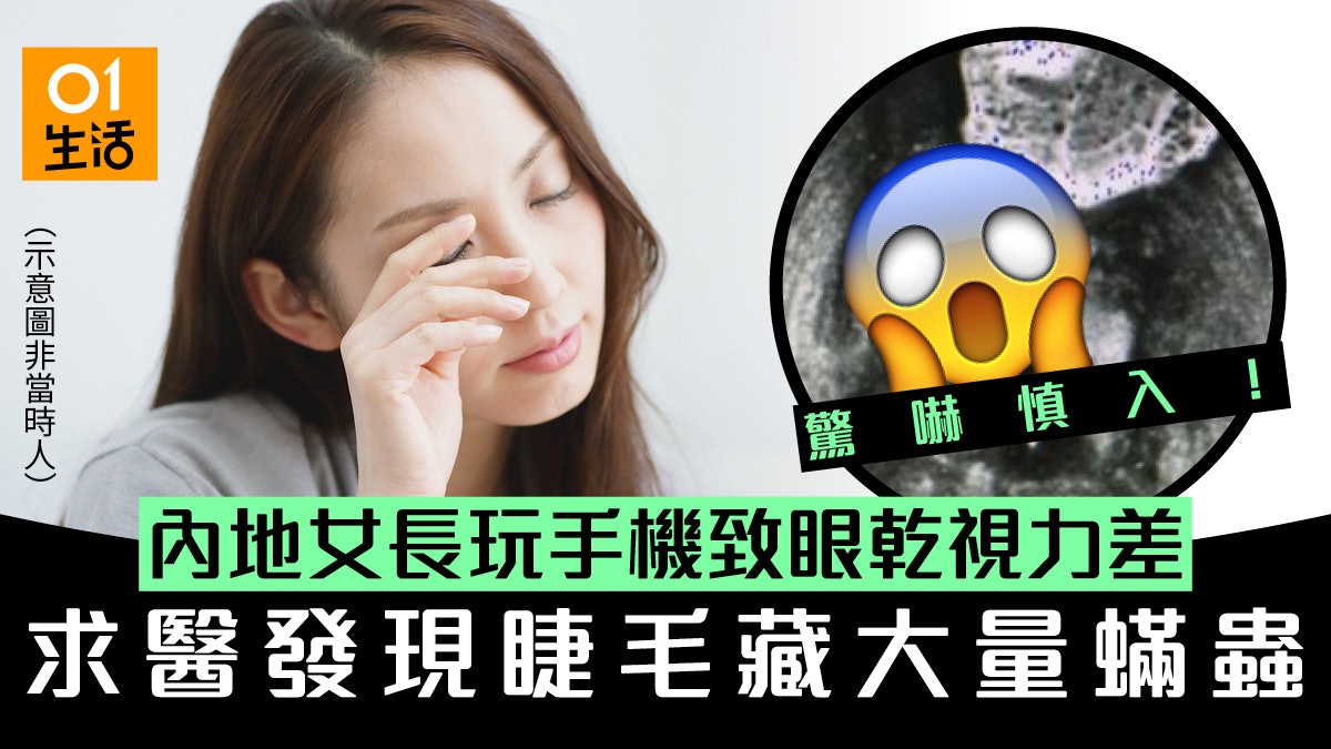女生狂玩手機眼乾刺痛求醫揭睫毛有大量蟎蟲!專家教4招護眼 女生狂玩手機眼乾刺痛求醫揭睫毛有大量蟎蟲!專家教4招護眼