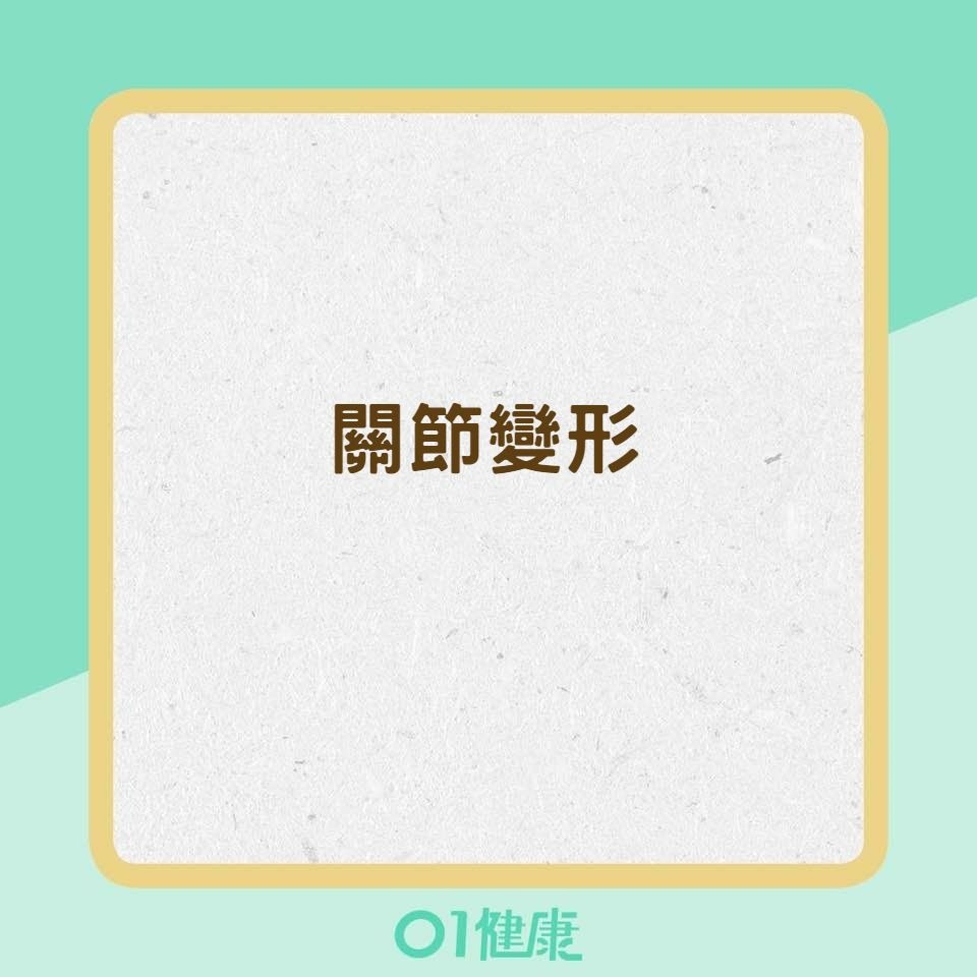自體免疫關節炎常見症狀(01製圖) 自體免疫關節炎常見症狀(01製圖)