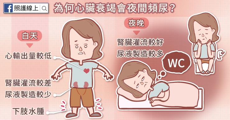 為何心臟衰竭會夜間頻尿?(照護線上授權使用) 為何心臟衰竭會夜間頻尿?(照護線上授權使用)