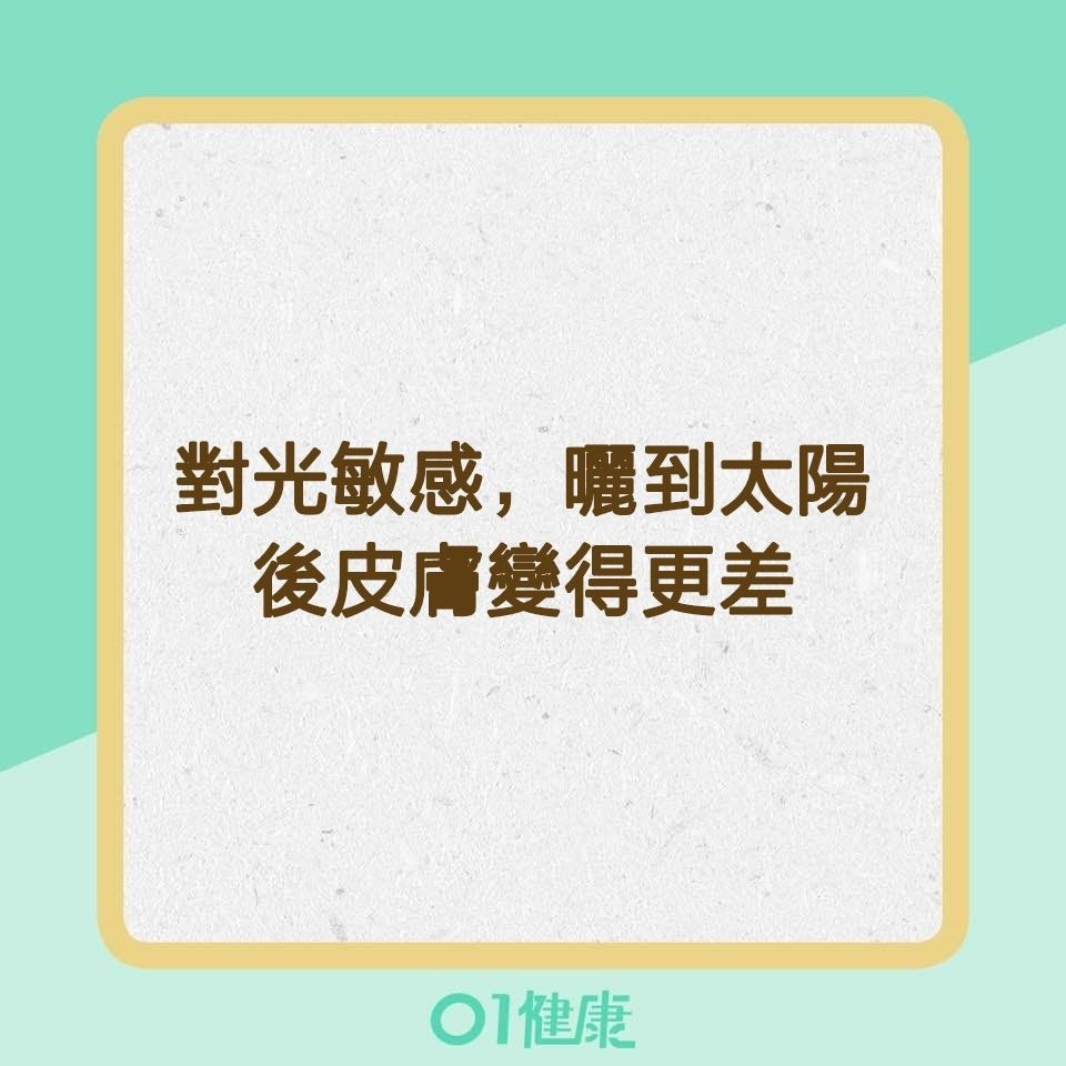 紅斑性狼瘡患者可能會出現的症狀（01製圖）