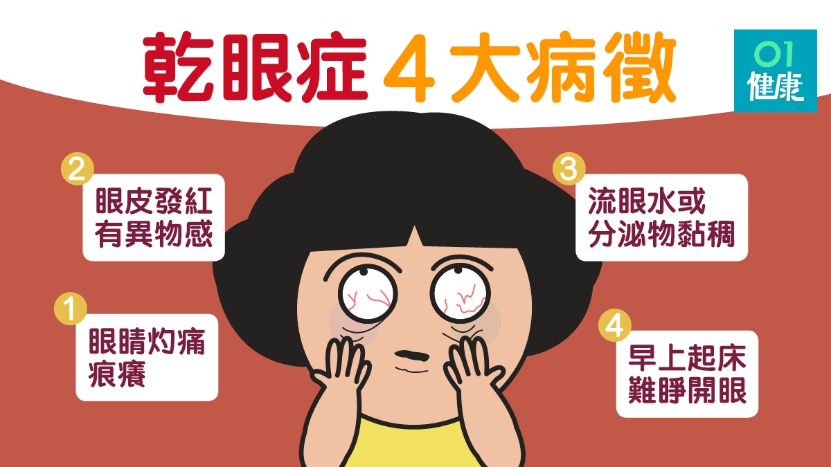 乾眼症 眼睛乾澀灼痛常流眼淚紓緩乾眼症熱敷食療懶人包 乾眼症 眼睛乾澀灼痛常流眼淚紓緩乾眼症熱敷食療懶人包