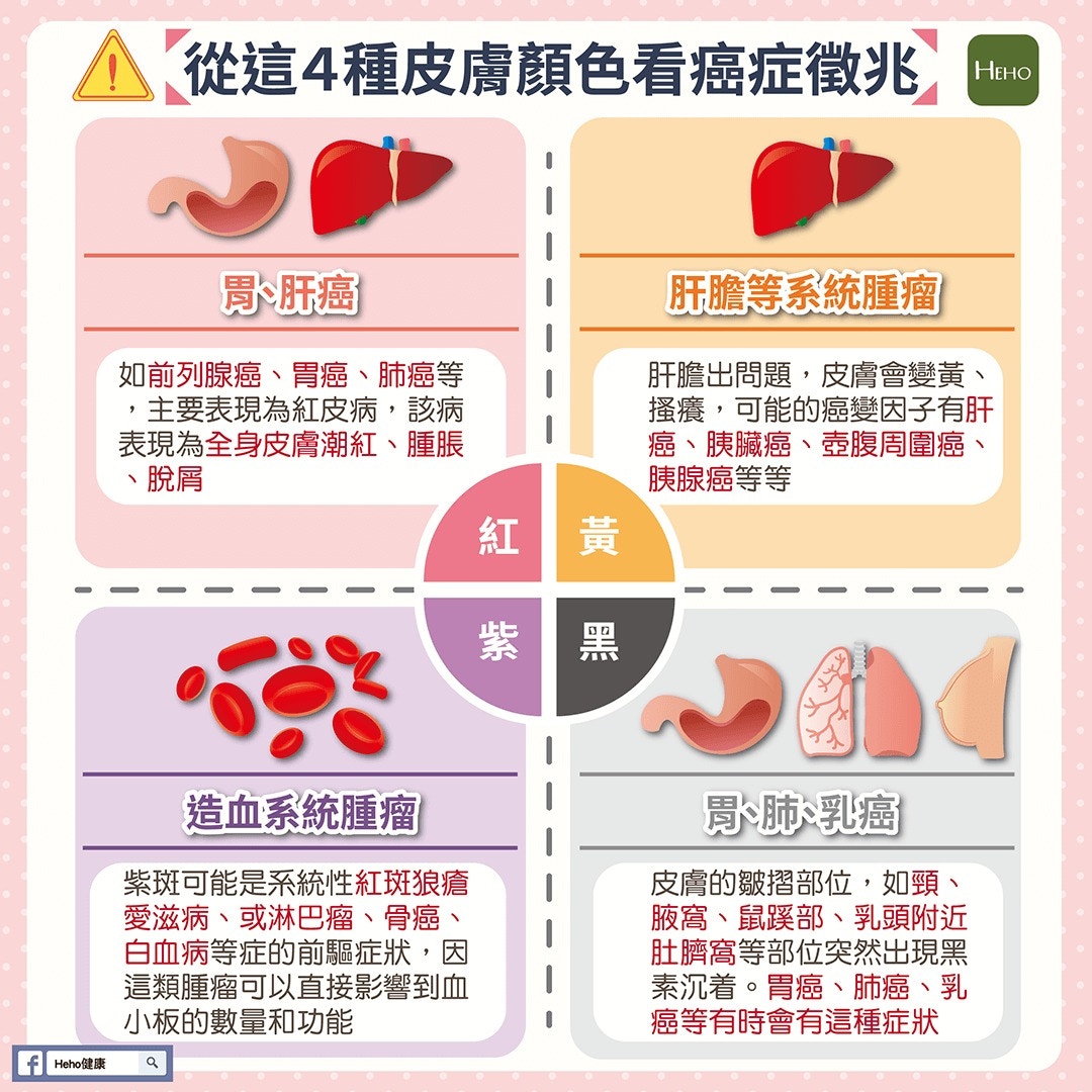 從這4種皮膚顏色看癌症徵兆（HEHO健康授權使用）