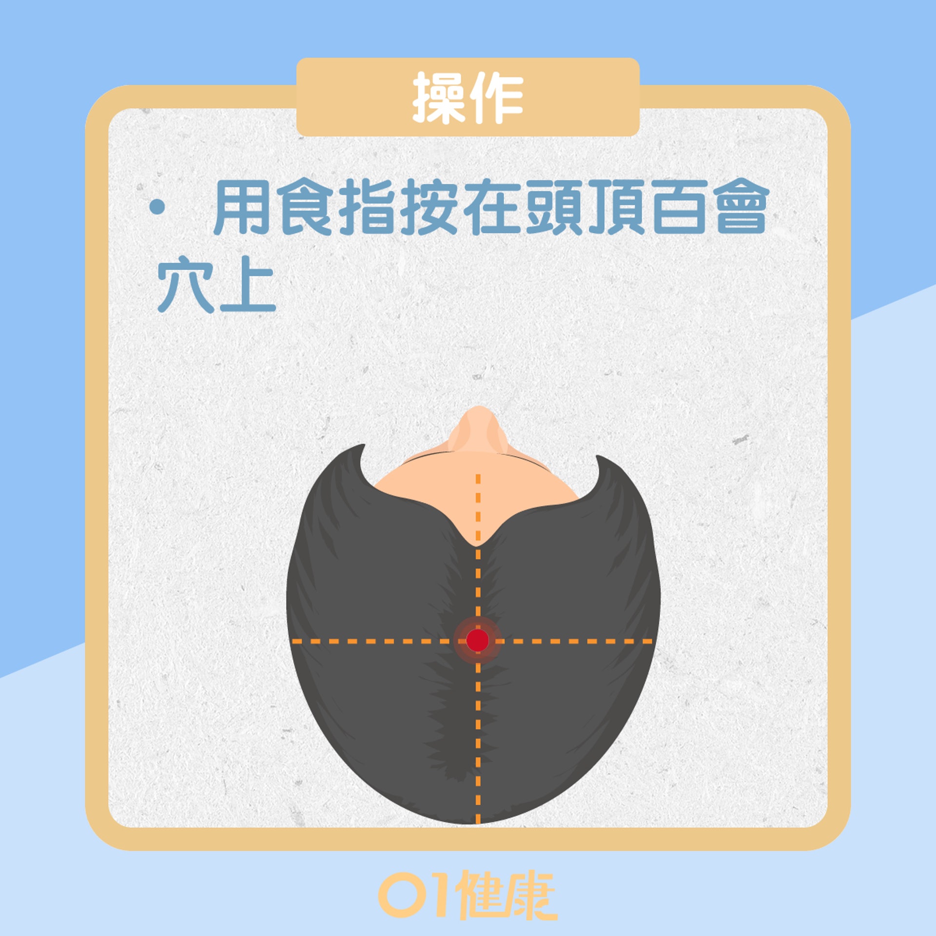 百會穴(01製圖) 百會穴(01製圖)