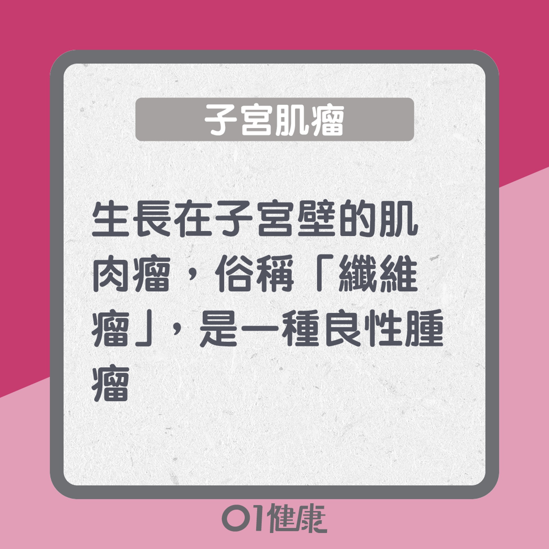 子宮肌瘤知多啲 (01製圖) 子宮肌瘤知多啲 (01製圖)