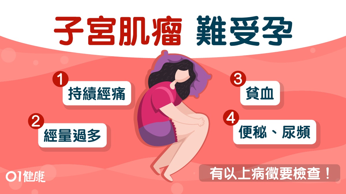 【子宮肌瘤】便秘尿頻或因腫瘤變大 約一半患者沒病徵可致難懷孕 【子宮肌瘤】便秘尿頻或因腫瘤變大 約一半患者沒病徵可致難懷孕