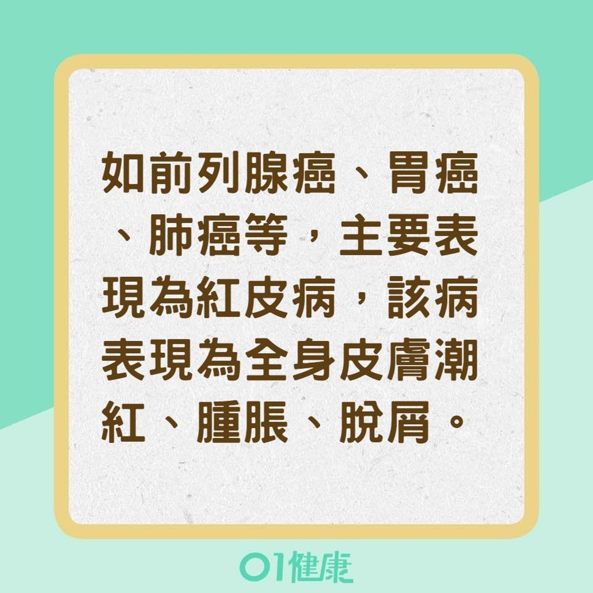 從這4種皮膚顏色看癌症徵兆(香港01製圖) 從這4種皮膚顏色看癌症徵兆(香港01製圖)