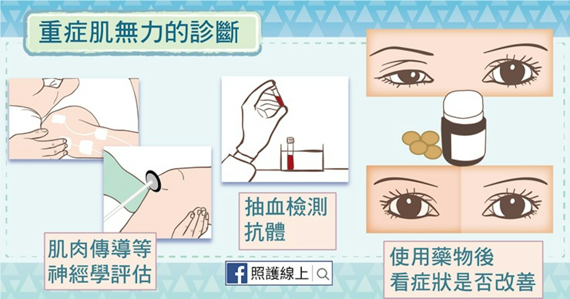 重症肌無力的診斷(照護線上授權使用) 重症肌無力的診斷(照護線上授權使用)