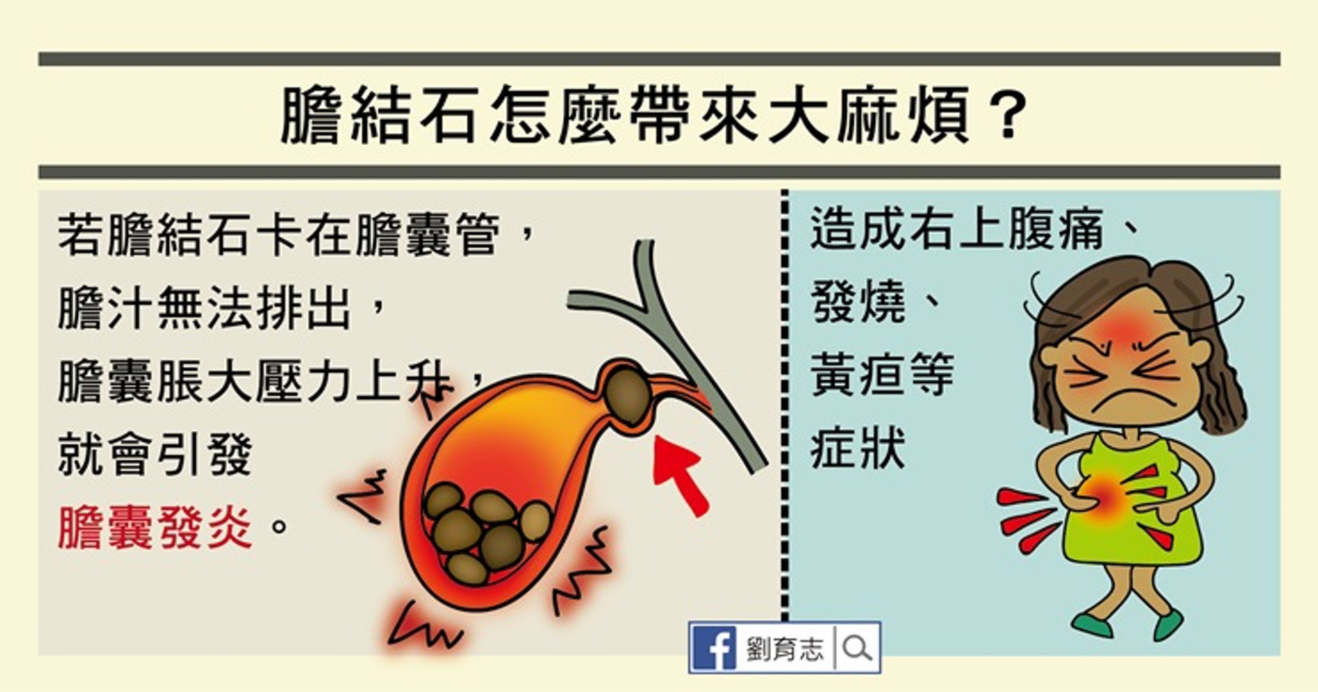 膽結石怎麼帶來大麻煩?(照護線上授權使用) 膽結石怎麼帶來大麻煩?(照護線上授權使用)