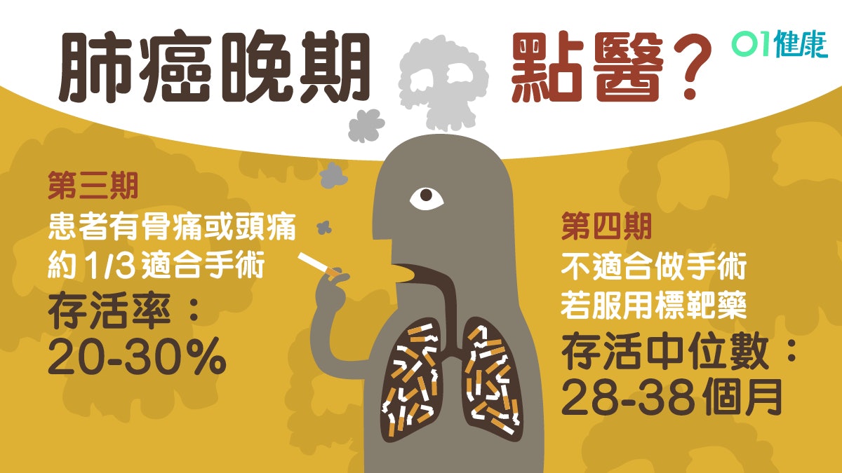 肺癌 沒吸煙及女性患者趨升 5個常見症狀頭痛骨痛或已第3期 香港01 健康