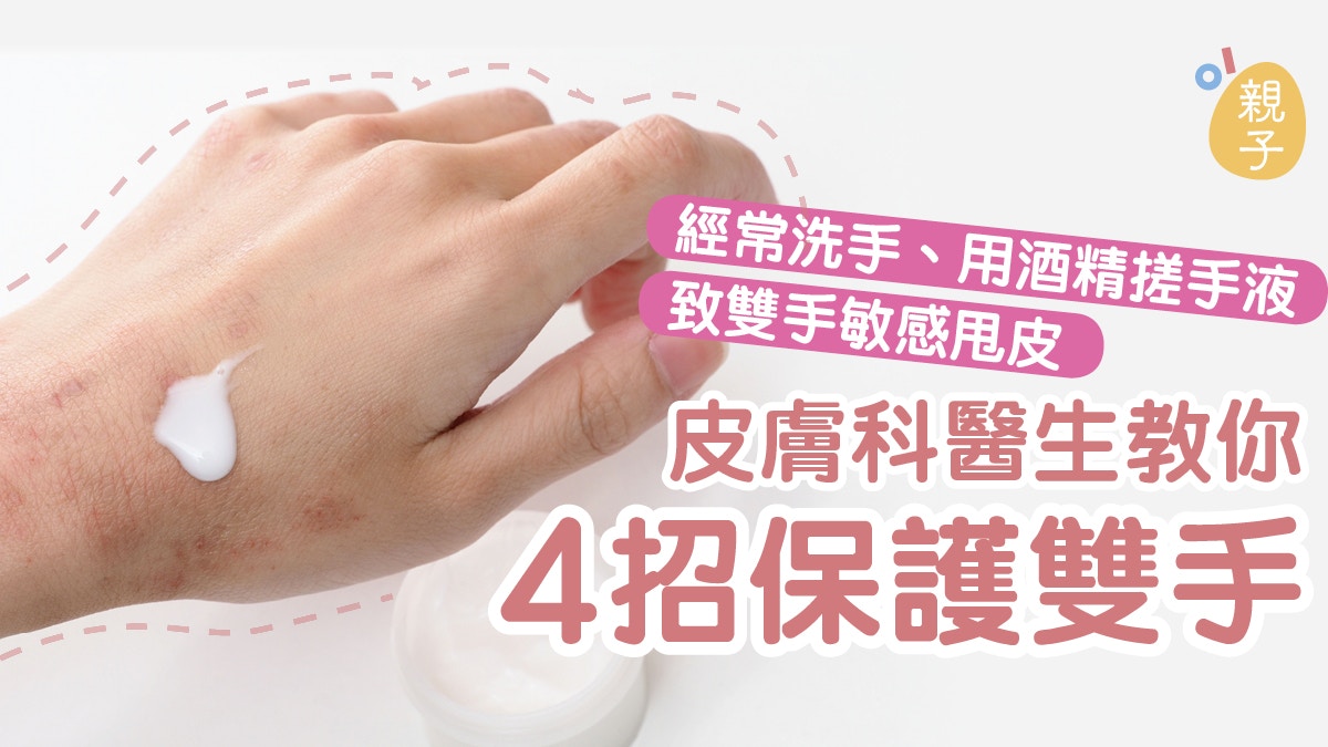 新冠肺炎 狂洗手用酒精搓手易傷手醫生 會令皮膚痕癢過敏 香港01 親子