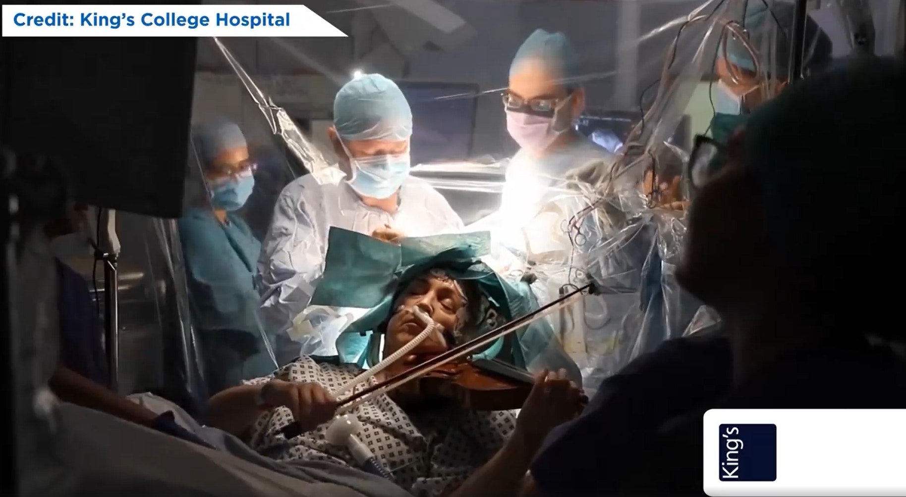 英國國王學院醫院（King's College Hospital）手術室內，一名病人在動開顱手術移除腦瘤的同時，一邊用小提琴演奏馬勒和哥舒詠的曲目，讓醫生可以即時觀察手術對這位病人的影響。（Facebook@
King's College Hospital London影片截圖）