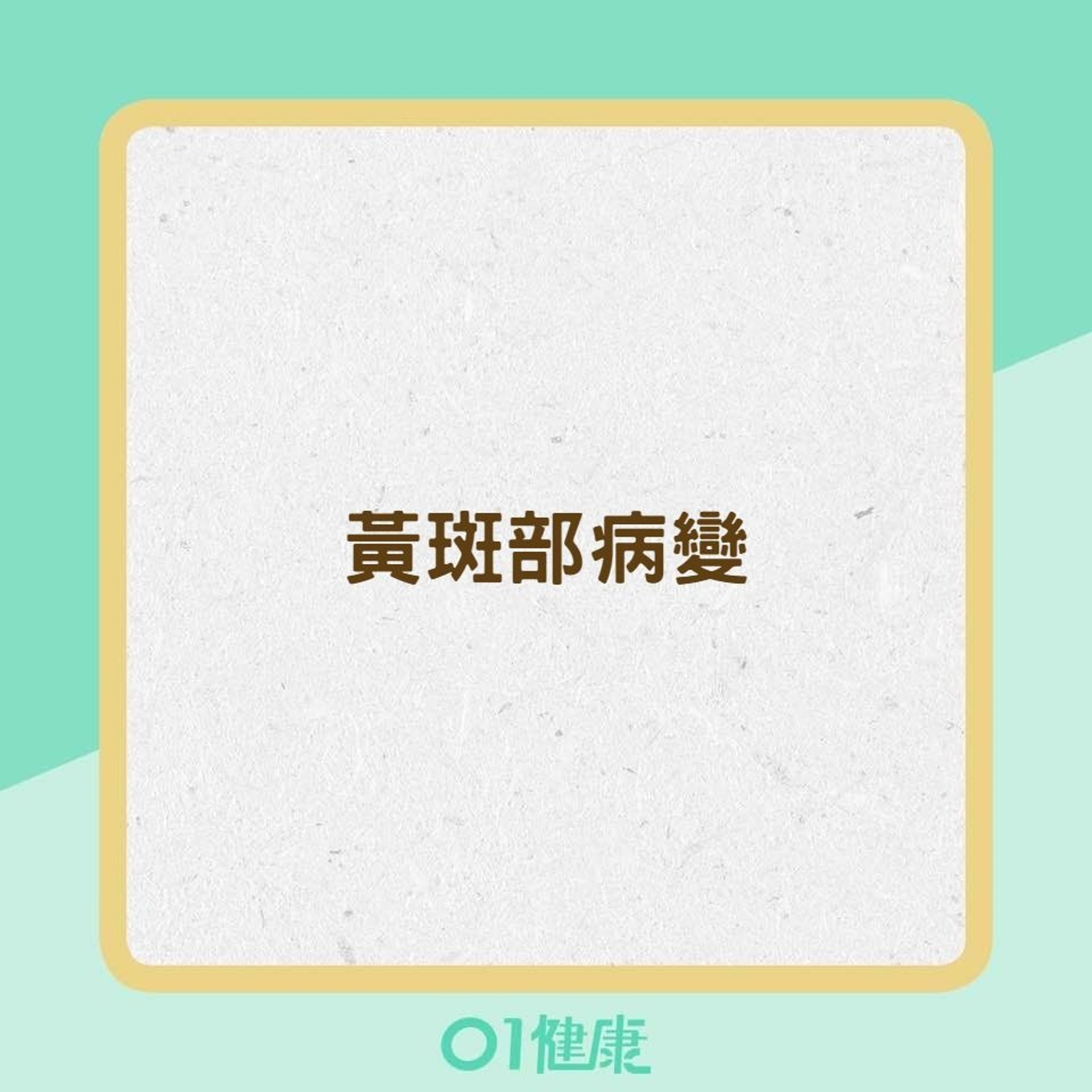 高度近視可能造成的疾病(01製圖) 高度近視可能造成的疾病(01製圖)